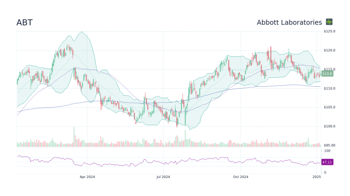 Price of Abbott Labs Stock A Comprehensive Guide